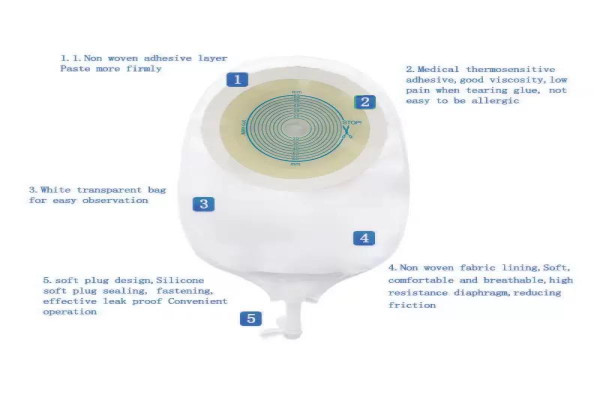 POCHE DE BRICKER (UROSTOMIE)